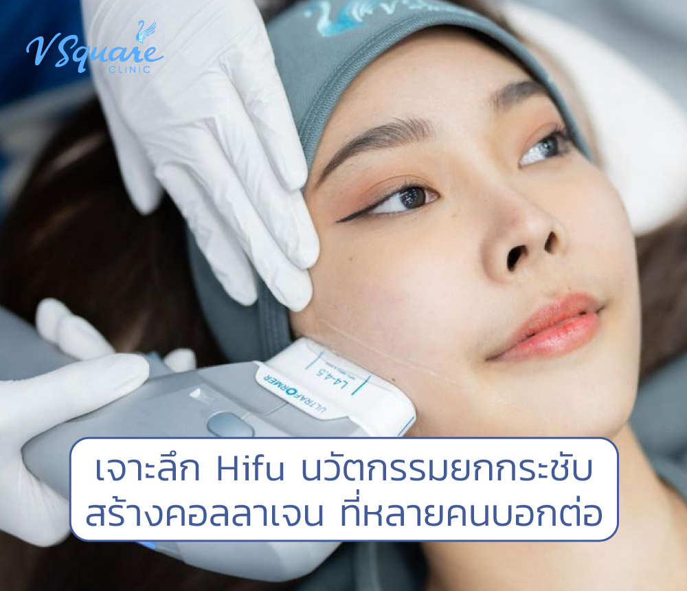 Hifu (ไฮฟู่)