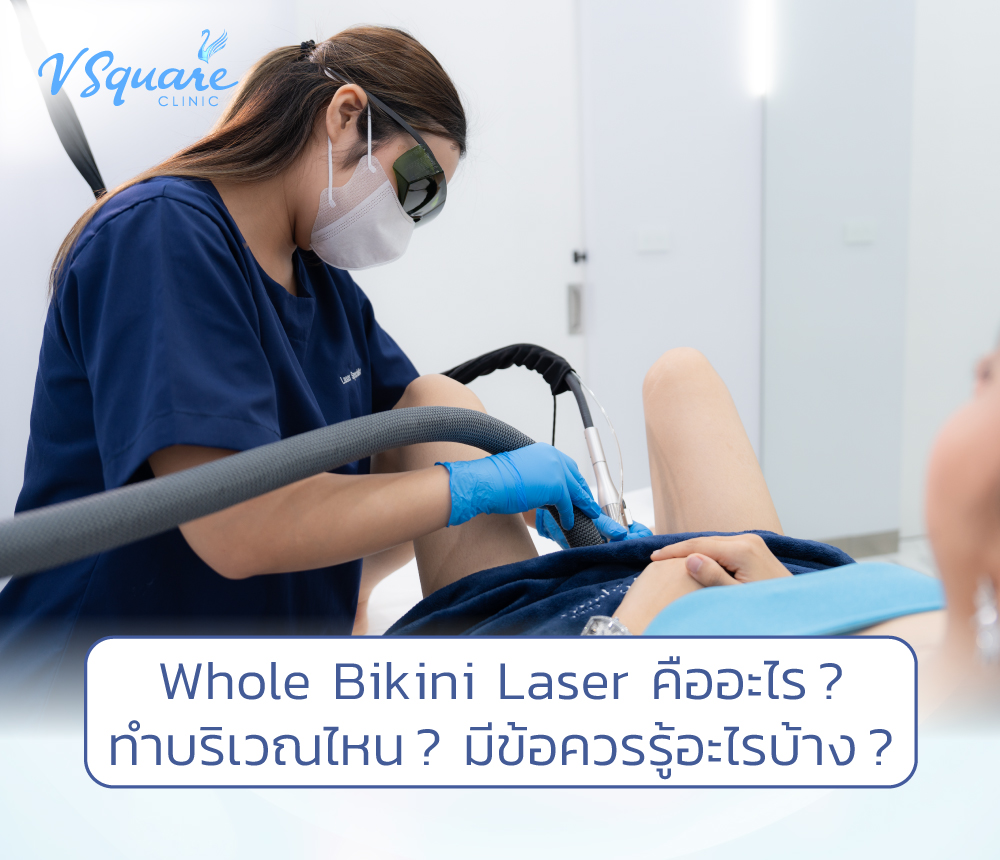 Whole Bikini Laser คืออะไร