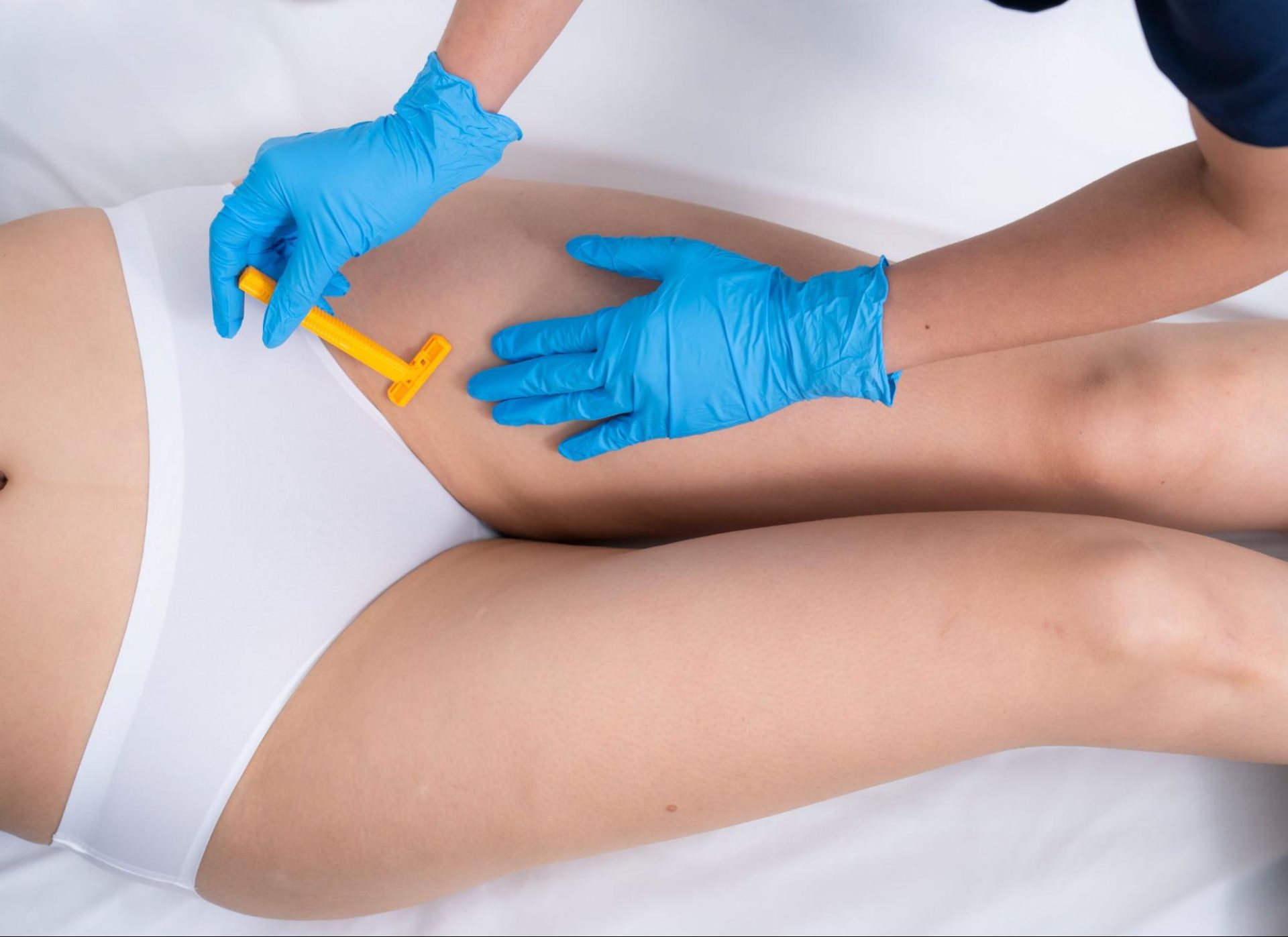 ขั้นตอนการทำ Whole Bikini Laser