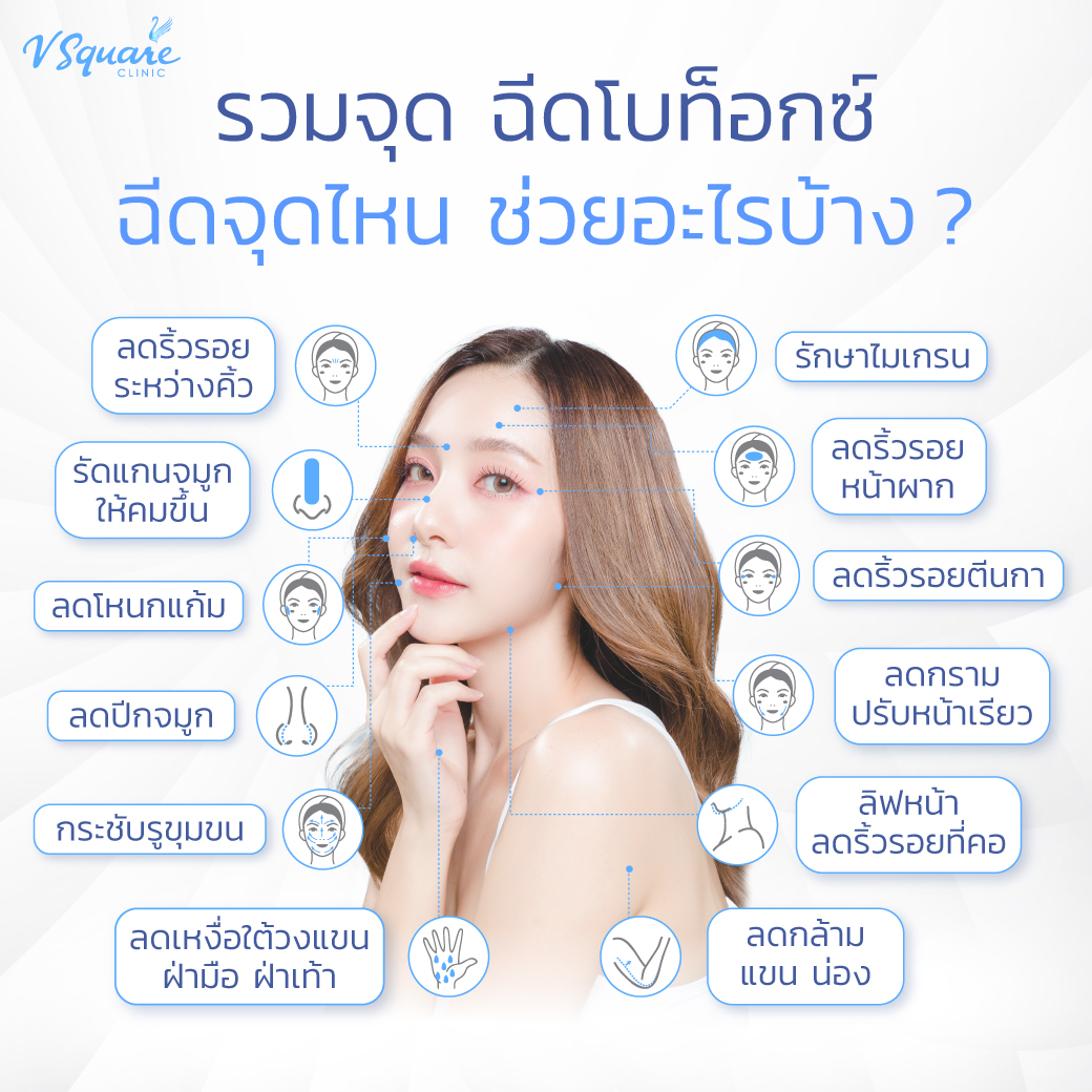 ฉีดโบท็อก ได้บริเวณไหนบ้าง