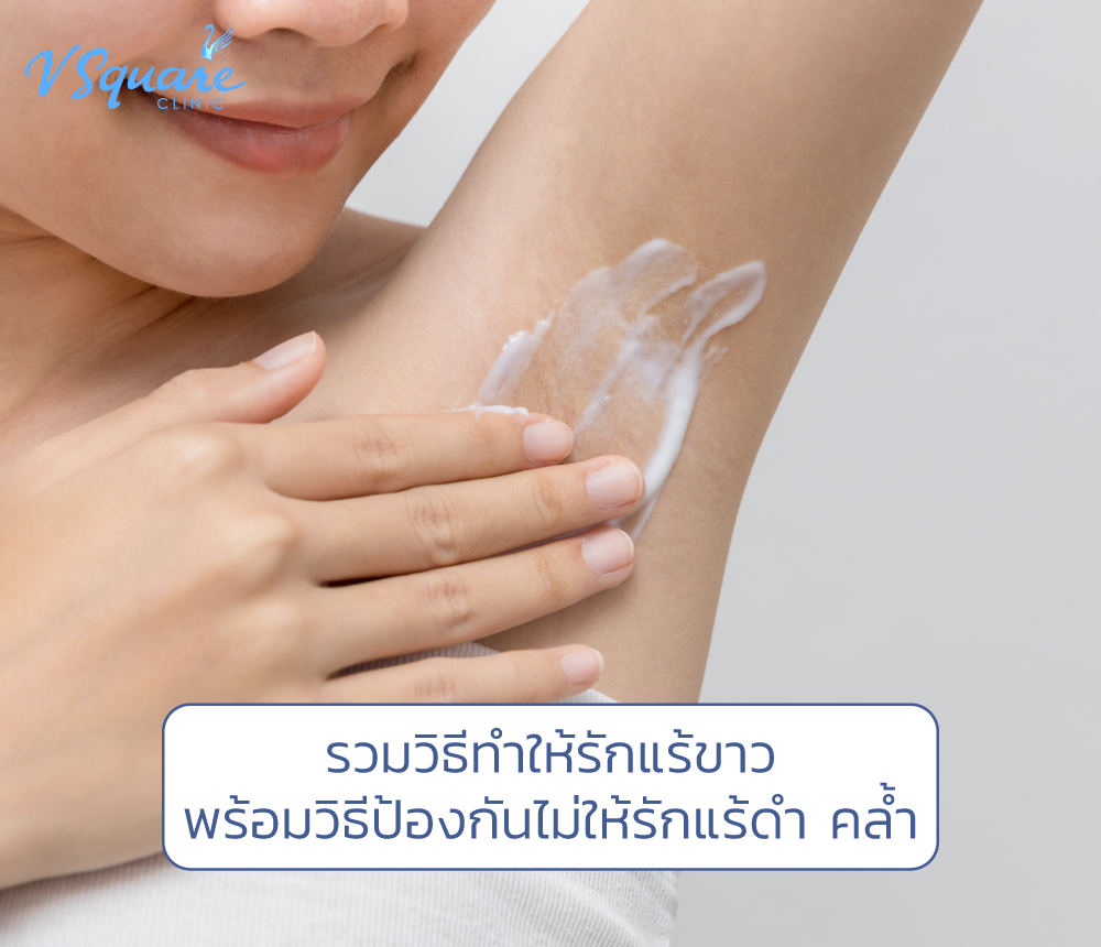รักแร้ขาว