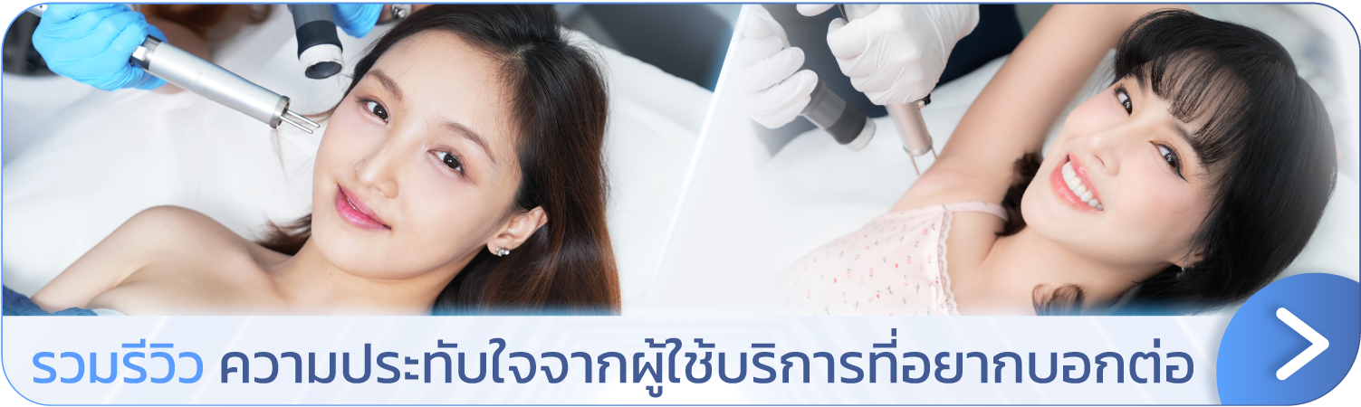 รีวิวเลเซอร์ขนที่ V Square Clinic