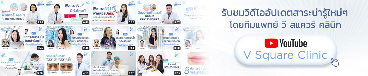 วิดีโอวีสแควร์