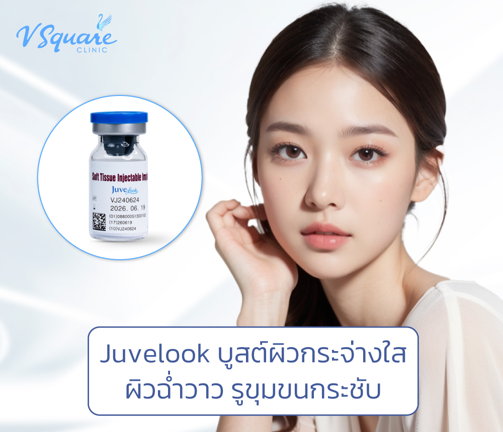 Juvelook