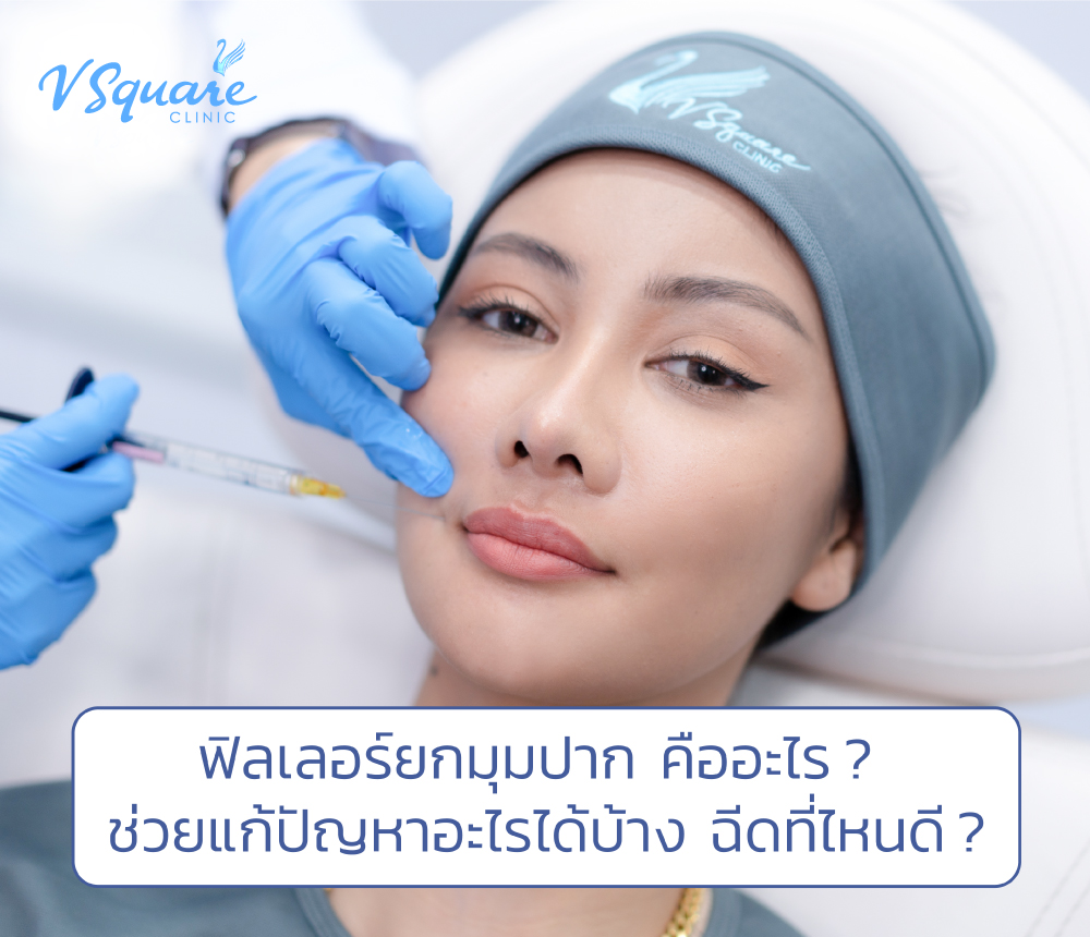 ฉีดฟิลเลอร์ยกมุมปาก