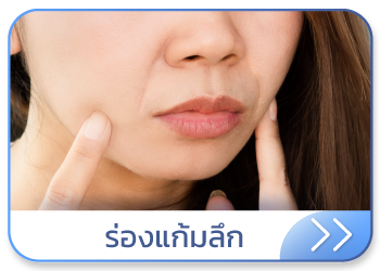 ร่องแก้มลึก