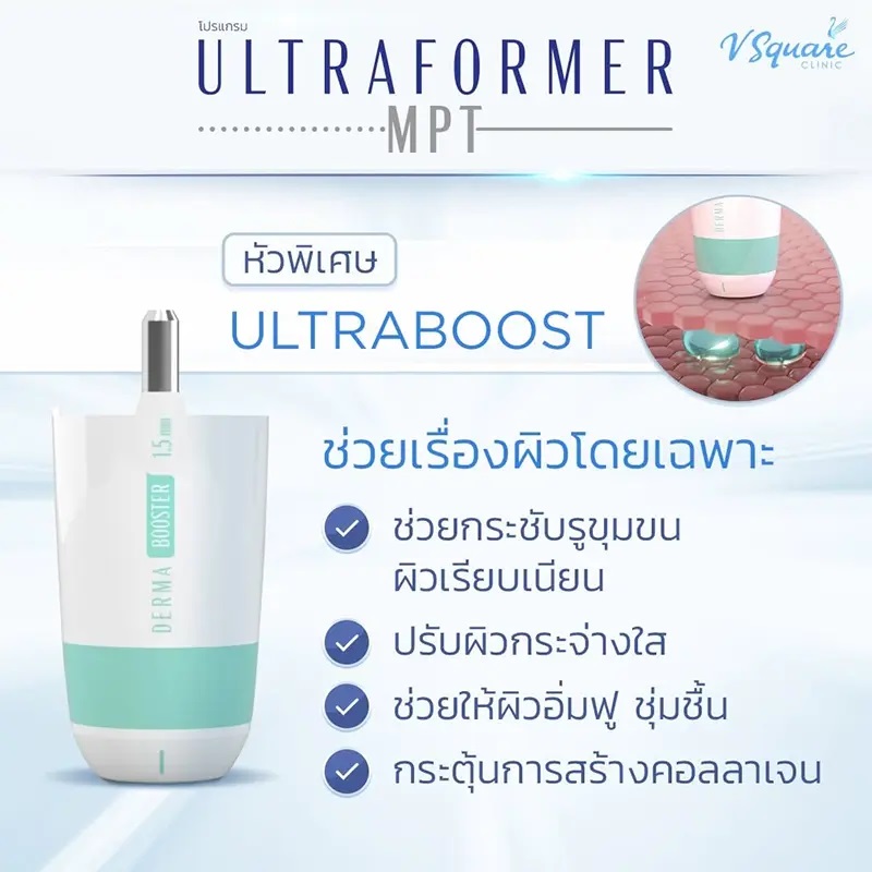 หัวยิงพิเศษ Ultraboost