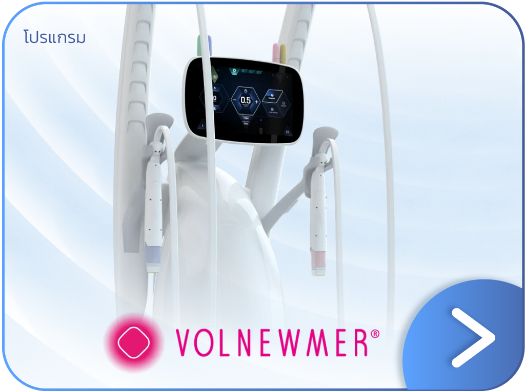 Volnewmer คือ