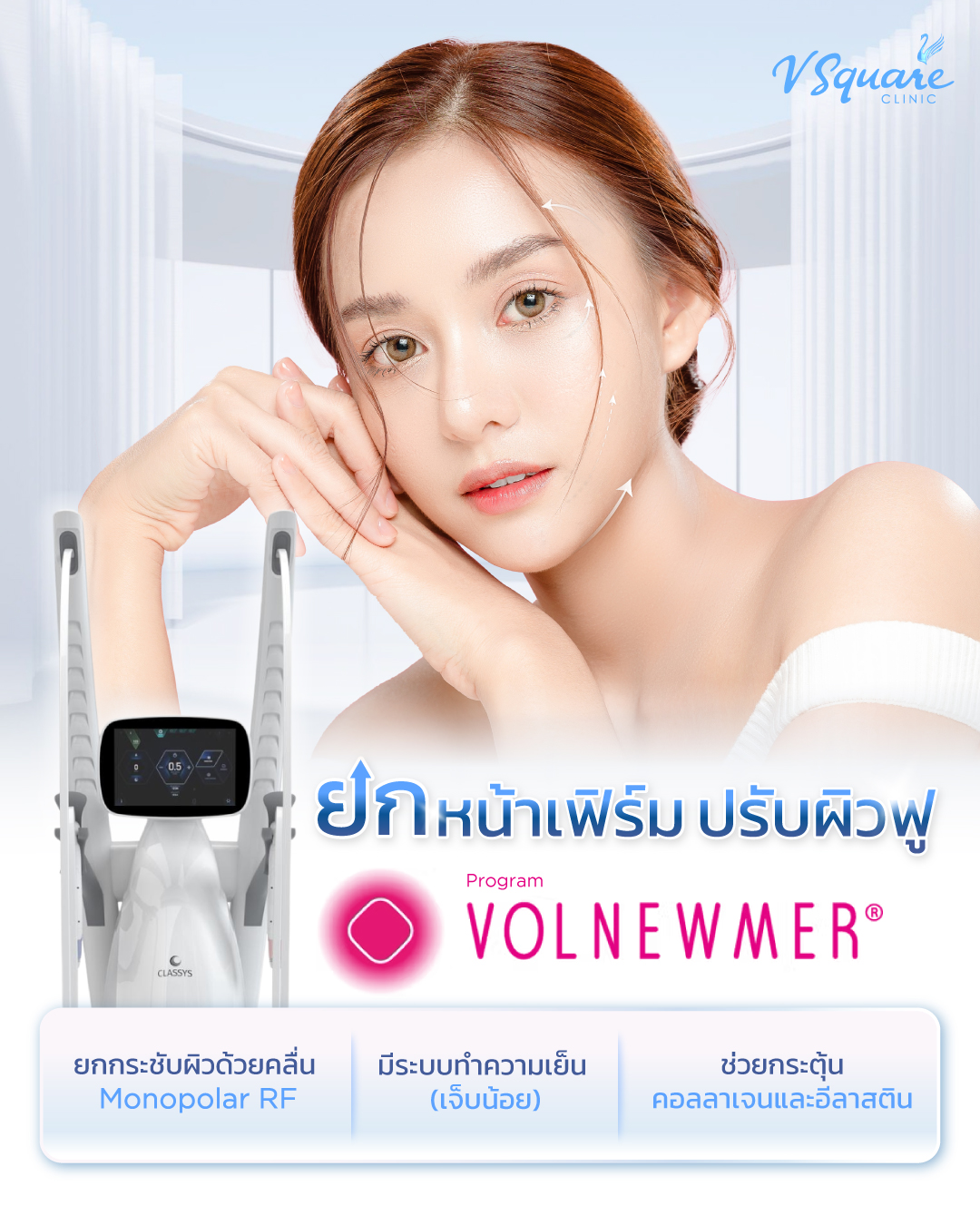 Volnewmer คืออะไร