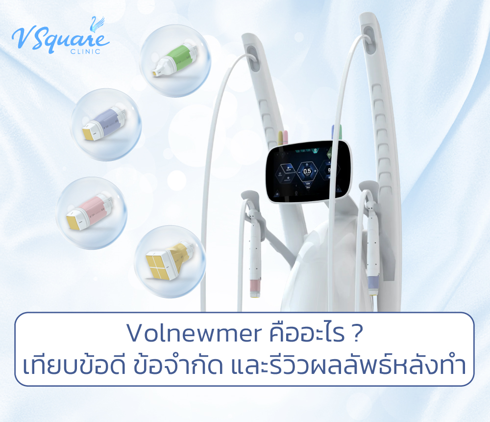 Volnewmer