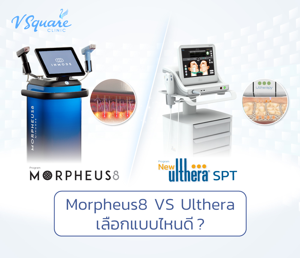 morpheus8 กับ ulthera ต่างกันยังไง