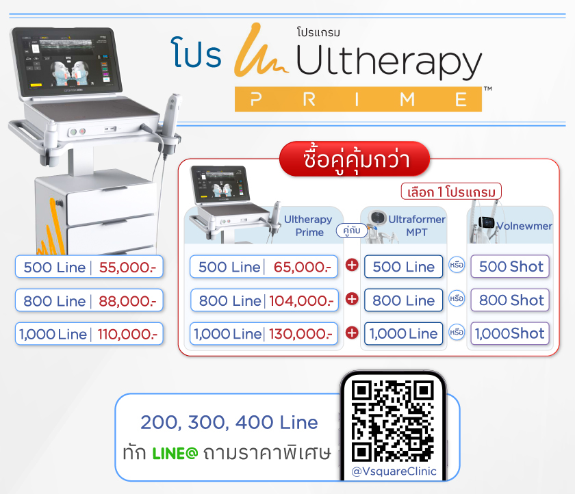 โปร SPT Prime Volnewmer