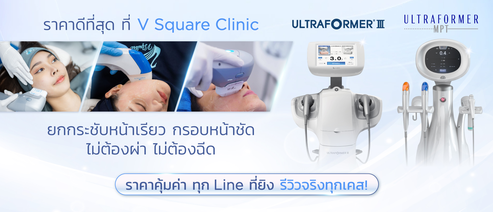 Hifu Ultraformer III ที่ V Square Clinic