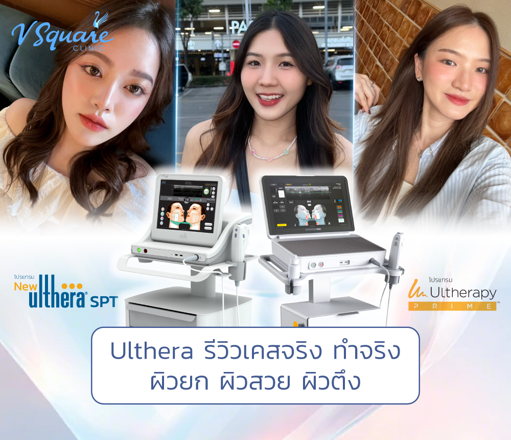 Ulthera Ruler Ulthera รีวิว 3 ผลลัพธ์ ผิวยก ผิวสวย ผิวตึง ที่พิสูจน์ได้