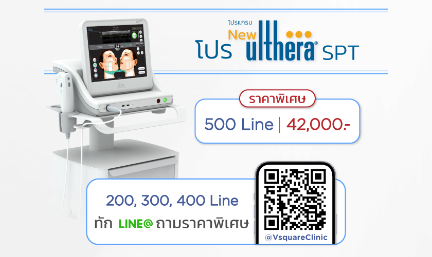 โปร Ultherapy SPT