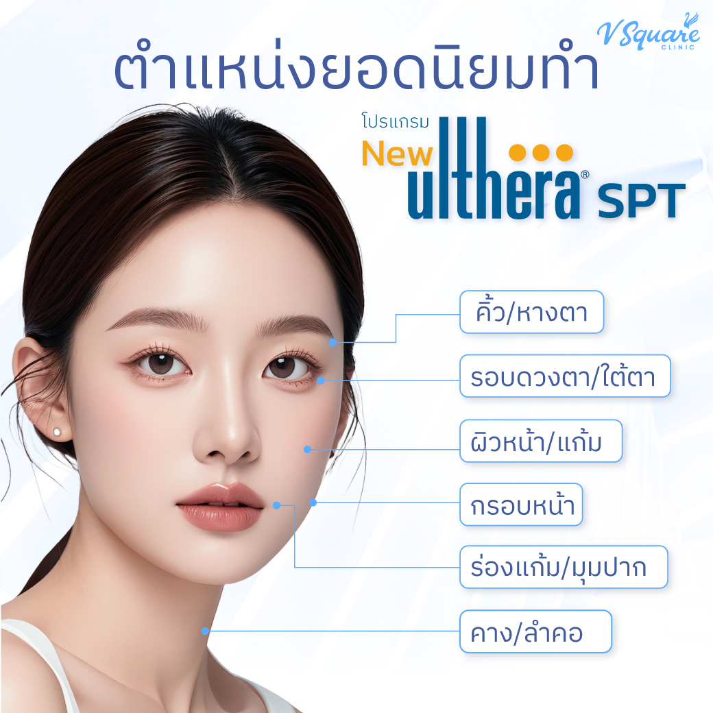 ตำแหน่งยอดนิยมทำ--Ulthera-SPT2