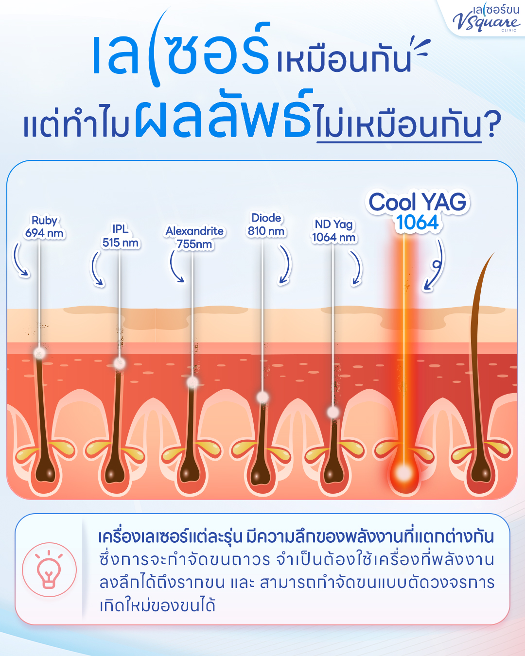 YAG Laser ต่างกับเครื่องอื่นอย่างไร