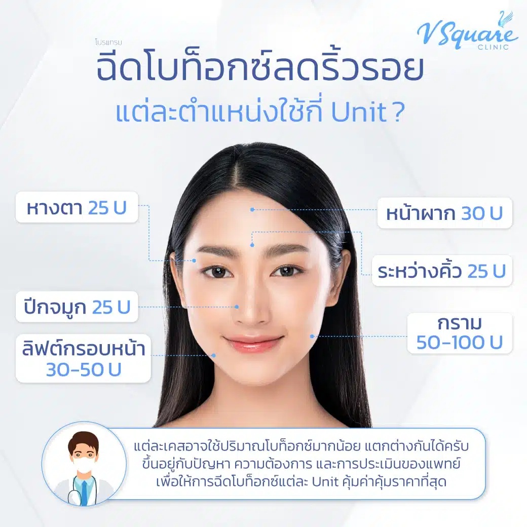 ฉีดโบท็อก Bienox ใช้กี่ยูนิต