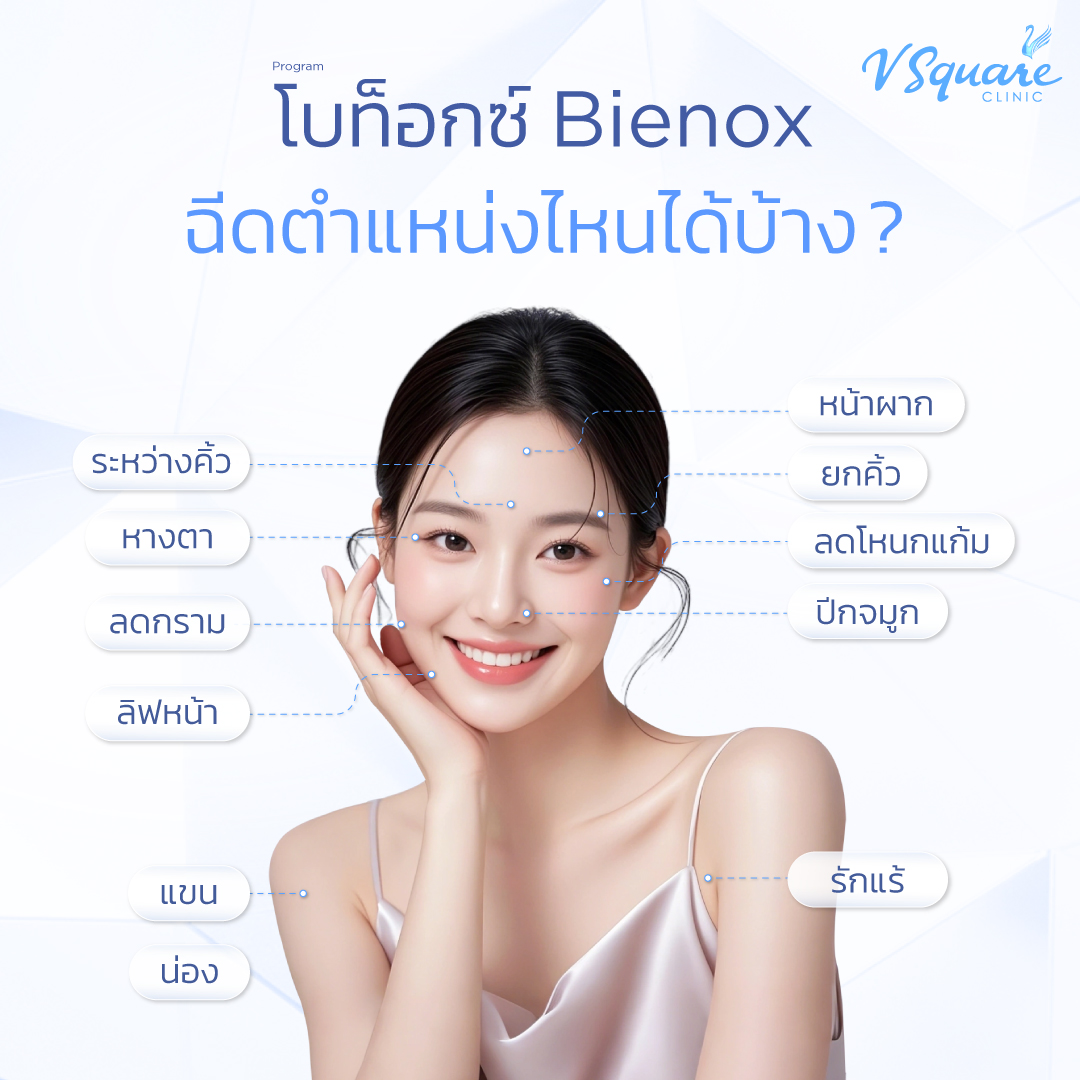 โบท็อก Bienox ฉีดจุดไหนได้บ้าง