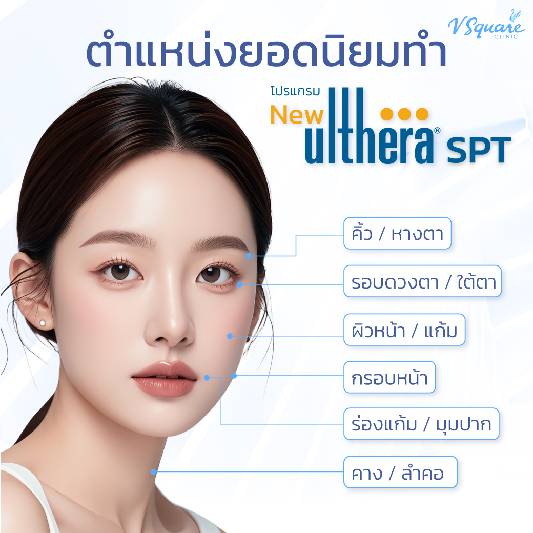 Emface กับ Ulthera ทำตำแหน่งไหนได้บ้าง