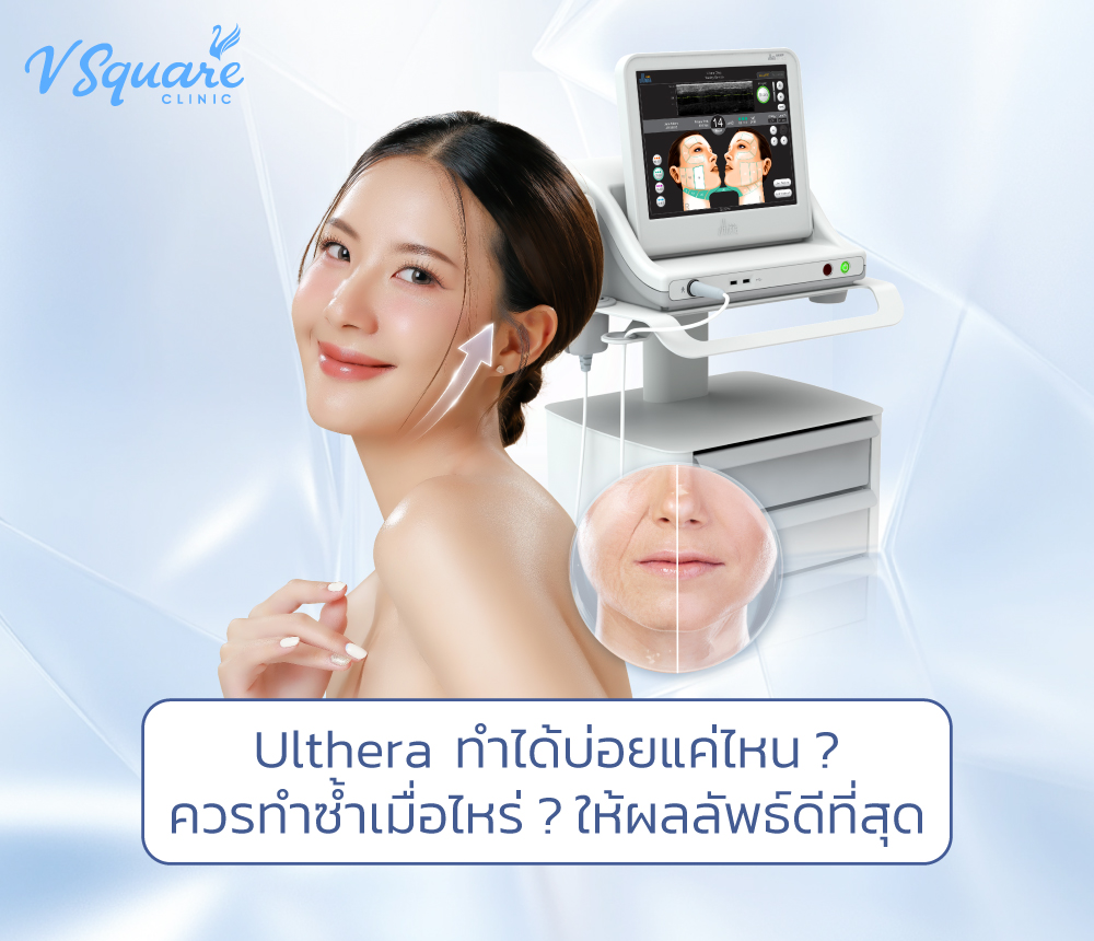 Ulthera ทำได้บ่อยแค่ไหน