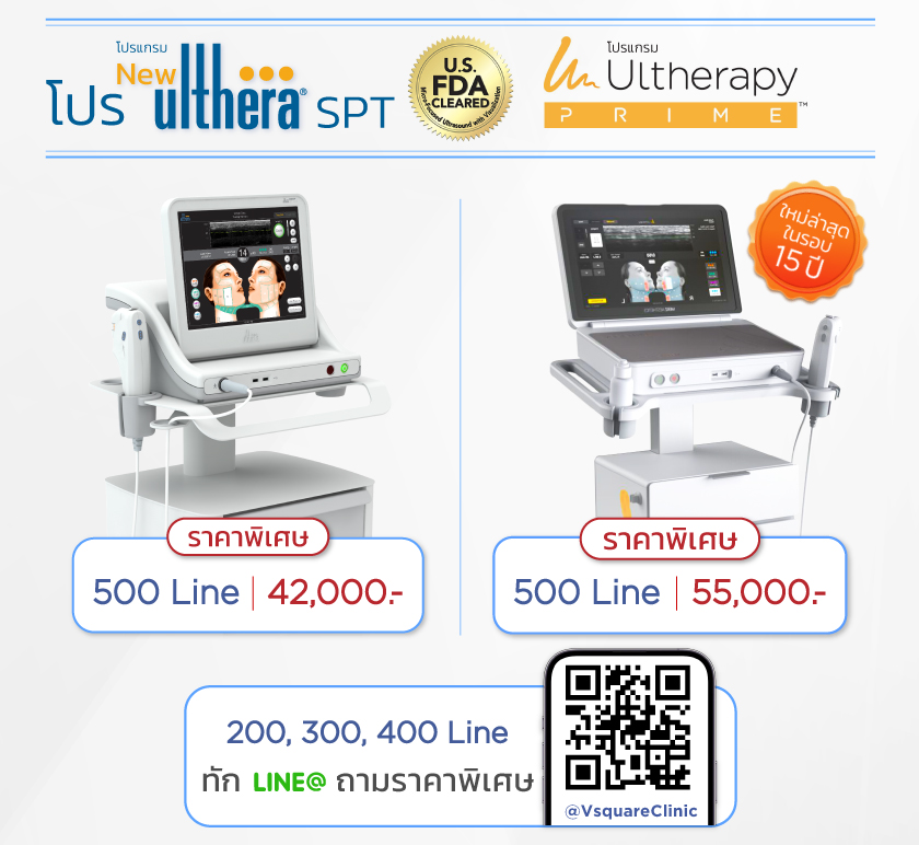 Ulthera ราคา