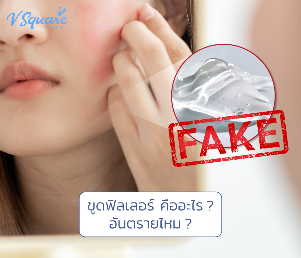 ขูดฟิลเลอร์