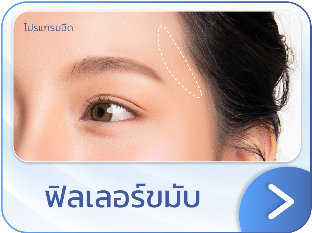 ฟิลเลอร์ขมับ