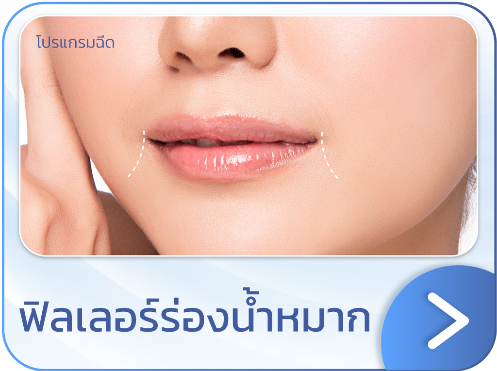 ฟิลเลอร์ร่องน้ำหมาก