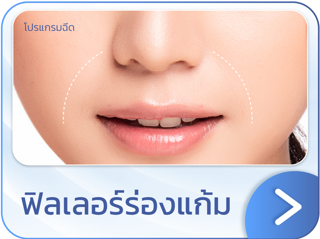 ฟิลเลอร์ร่องแก้ม
