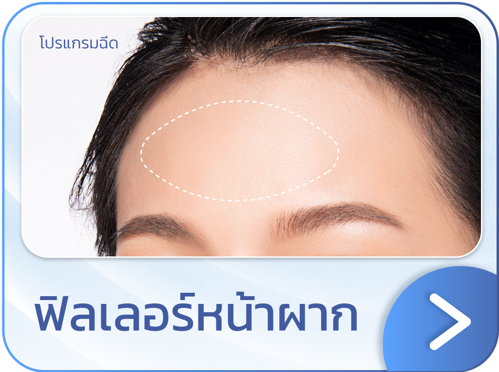 ฟิลเลอร์หน้าผาก