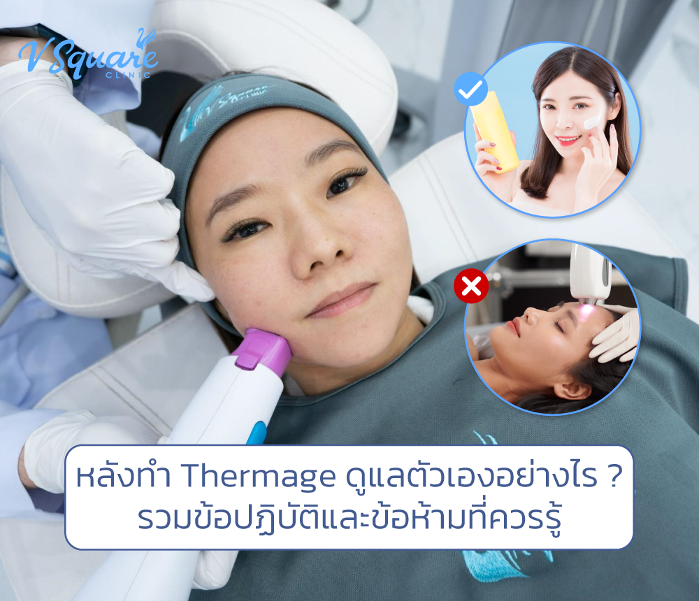 หลังทำ Thermage