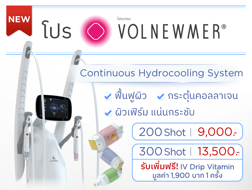 โปรโมชั่น volnewmer